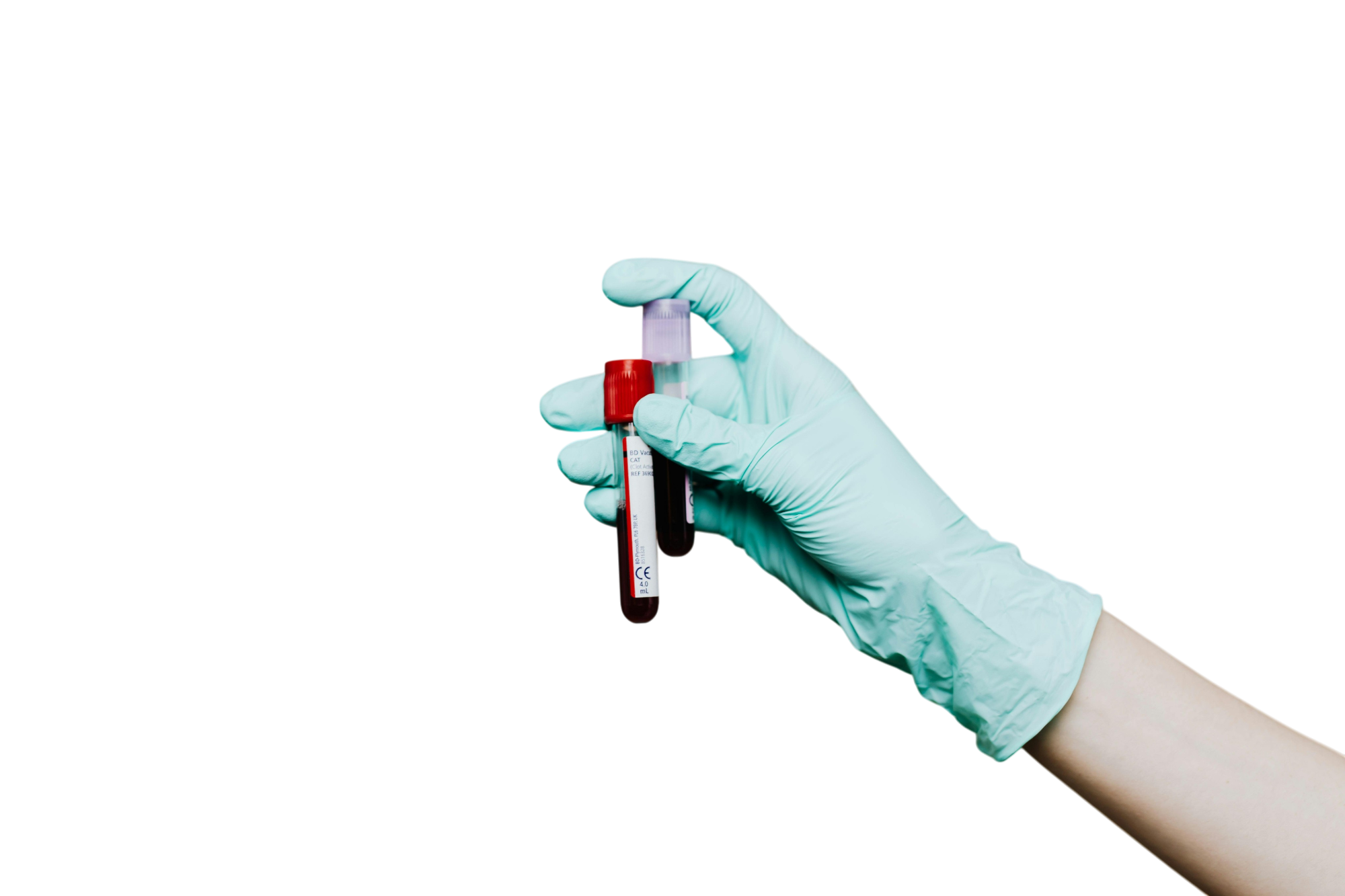 Анализ крови на хлориды в Москве