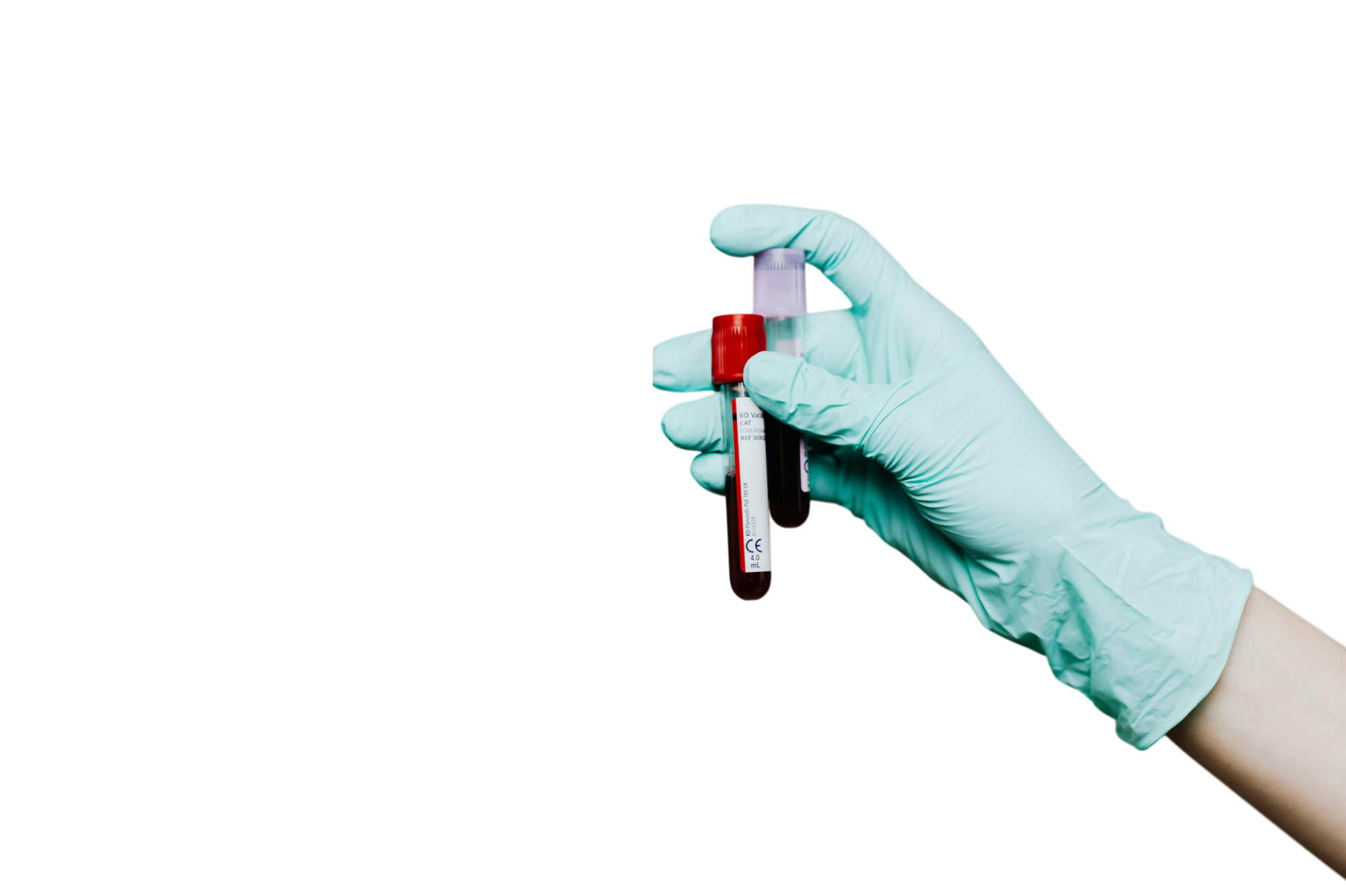 Анализ крови на адренокортикотропный гормон в Москве