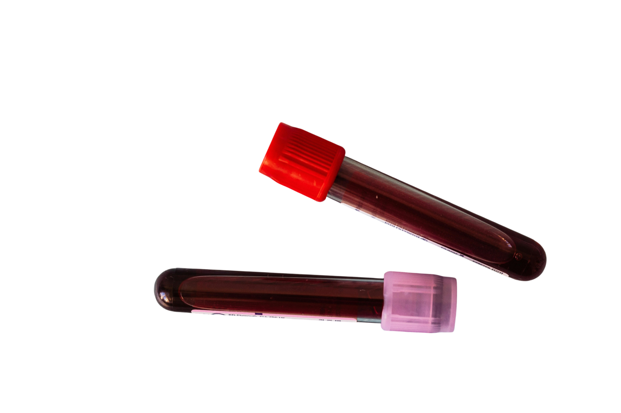 Анализ крови на витамин В12 в Москве